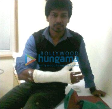 Nikhil Dwivedi injured while shooting for Hate Story