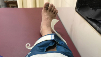 OMG: Arshad Warsi injures his leg during a dance sequence and here is what he said