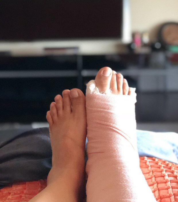 Farah Khan to choreograph for Sonam Kapoor – Anand Ahuja’s sangeet despite fractured foot