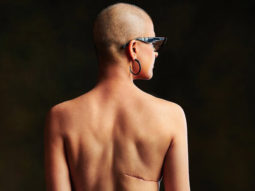 Tahira Kashyap Khurrana goes backless, proudly bears her scars in a powerful message on World Cancer Day