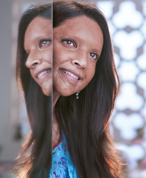 Deepika Padukone's Chhapaak look wins praises from Ranveer Singh, Alia Bhatt, Priyanka Chopra, Varun Dhawan, Vicky Kaushal amongst others