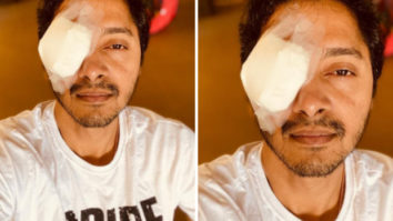 Shreyas Talpade injures his eye during lockdown, gives an update on his condition