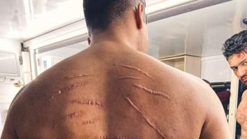 Vicky Kaushal shows his scars in behind-the-scenes photo from Sardar Udham