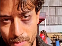 Tiger Shroff suffers an eye injury while filming Ganapath in the UK, shares photo