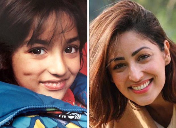 EXCLUSIVE: How Yami Gautam’s childhood injury got her an extra dimple