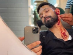 Vikrant Massey builds anticipation around his next project with a ‘bloody’ selfie