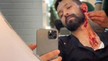 Vikrant Massey builds anticipation around his next project with a ‘bloody’ selfie