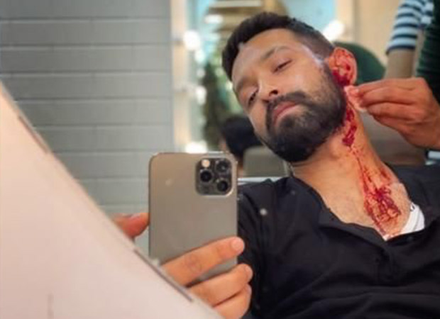 Vikrant Massey builds anticipation with a 'bloody' selfie