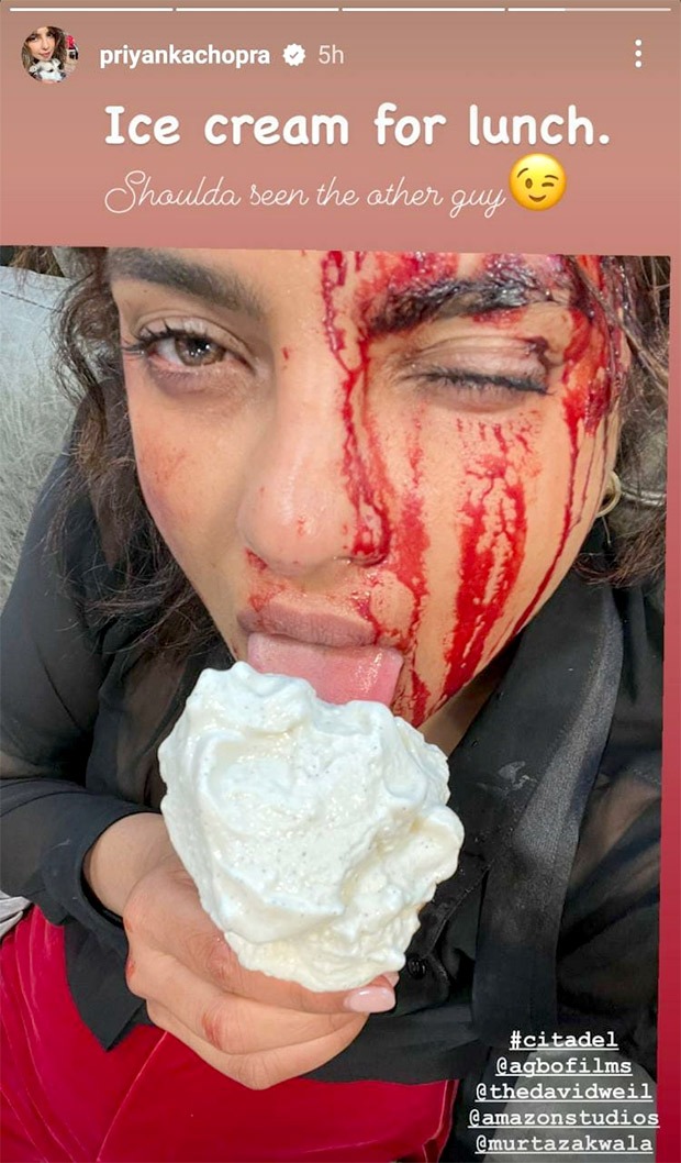 Priyanka Chopra is bloodied and bruised as she enjoys ice-cream on the sets of Citadel
