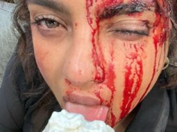 Priyanka Chopra is bloodied and bruised as she enjoys ice-cream on the sets of Citadel