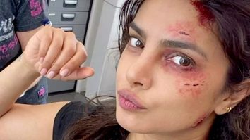 Blood & Sweat! Priyanka Chopra Jonas has given it all for Citadel