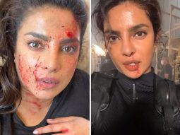 Priyanka Chopra says her ‘glamorous’ job involves blood, sweat and tears, shares a bloody and bruised video from Citadel set ahead of finale