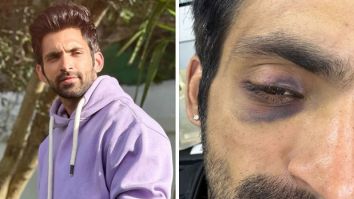 Khatron Ke Khiladi 13: Arjit Taneja gets injured while performing a stunt