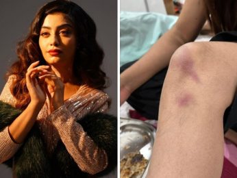Udaariyaan star Twinkle Arora gets injured while performing a stunt on sets, continues to shoot post applying make up on bruises Udaariyaan star Twinkle Arora gets injured while performing a stunt on sets, continues to shoot post applying make up on bruises