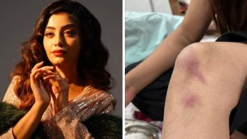Udaariyaan star Twinkle Arora gets injured while performing a stunt on sets, continues to shoot post applying make up on bruises