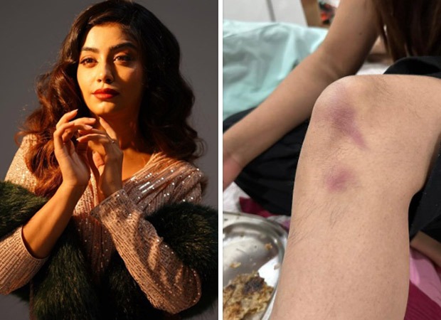 Udaariyaan star Twinkle Arora gets injured while performing a stunt on sets, continues to shoot post applying make up on bruises