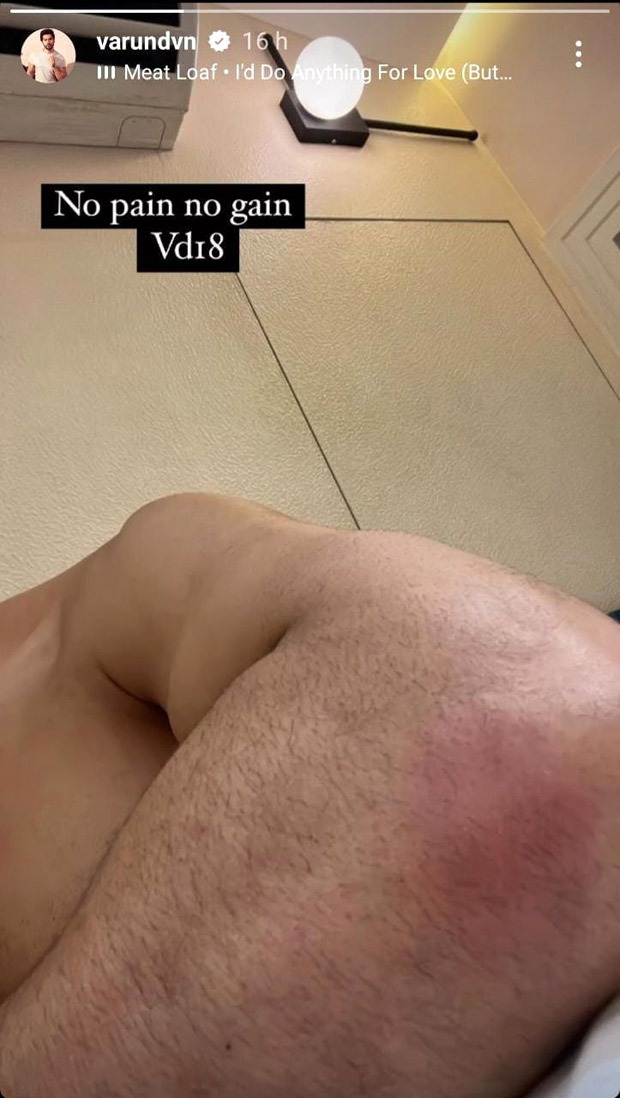 VD 18: Varun Dhawan gets injured a day after he begins shooting for Atlee’s next VD 18: Varun Dhawan gets injured a day after he begins shooting for Atlee’s next