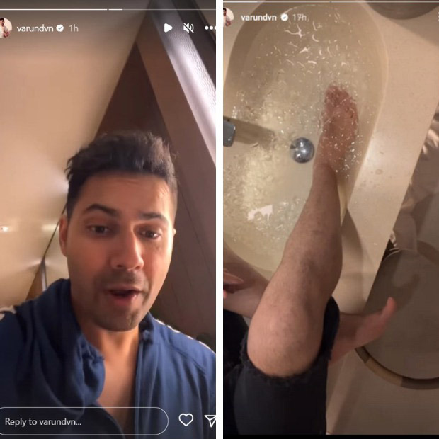 Varun Dhawan faces on-set challenge: Injures leg amid Atlee's VD18 production
