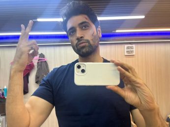 Adivi Sesh unveils gritty look for G2 with scarred selfie Adivi Sesh unveils gritty look for G2 with scarred selfie