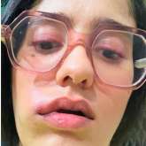 GHKPM actress Ayesha Singh reveals ‘no accurate diagnosis’ for her face swelling; says, “I have connected with a third doctor, and yet we can’t pinpoint the root cause”