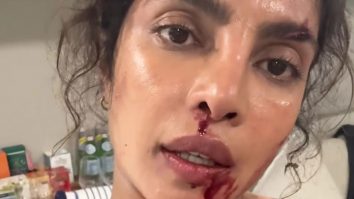 Action movies require blood & sweat, quiet literally & Priyanka Chopra proves it!