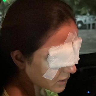 Jasmin Bhasin battles corneal damage after lens mishap, leaves her in pain