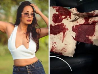 Kashmera Shah narrowly escapes “freak” accident in the USA, shares photo of blood-soaked tissue: “Kuch bada hone wala tha…”