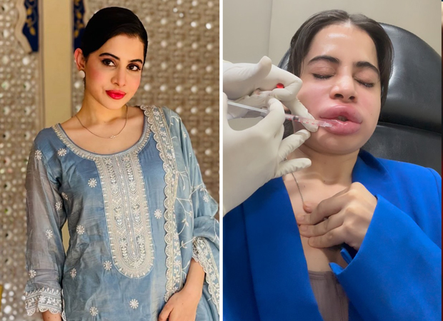 Uorfi Javed gets lip fillers dissolved on camera; reveals painful experience and future plans