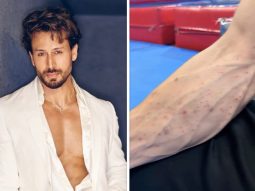 Tiger Shroff team shares video of his injuries after Juhu firing incident; actor reportedly sustained cuts and bruises