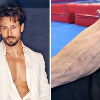 Tiger Shroff team shares video of his injuries after Juhu firing incident; actor reportedly sustained cuts and bruises