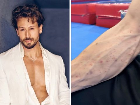 Tiger Shroff team shares video of his injuries after Juhu firing incident; actor reportedly sustained cuts and bruises Tiger Shroff team shares video of his injuries after Juhu firing incident; actor reportedly sustained cuts and bruises