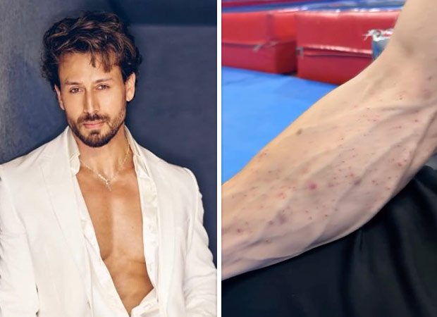 Tiger Shroff team shares video of his injuries after Juhu firing incident; actor reportedly sustained cuts and bruises